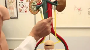 أسباب الحصوة في الحالب