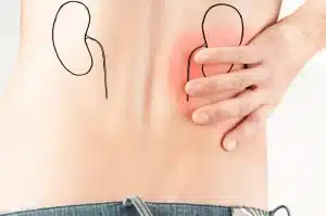 ما هي أسباب التهاب الكلى
